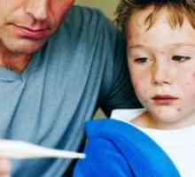 Алергични към отровен бръшлян при деца, симптоми, причини, лечение