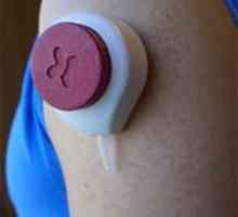 Изпитването на кръв без болка чрез вакуумна