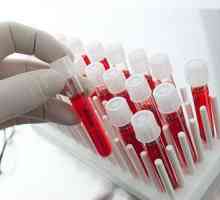 Кръвни тестове за opistorhoz (IFA, Biochemistry), антитела (ATM)