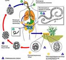 Човешки паразити нематоди (хелминти, червеи), аскариоза заболяване при възрастни
