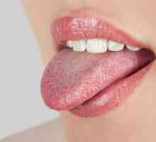 Бяла диария език