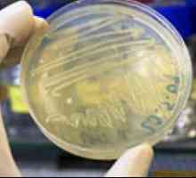 Биохимичен анализ на фекални бактерии свръхрастеж