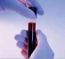 Биохимичен анализ на кръв за панкреатит