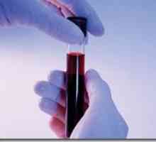 Биохимичен анализ на кръв