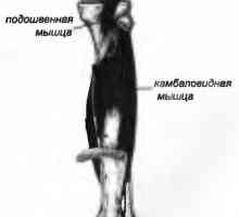 Болки в гърба, причинени от мускул от ходилото