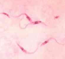 Chagas заболяване: симптоми, лечение, причините, диагноза, причини