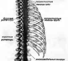 Болки в гърба, причинени от дълбоките параспинални мускули