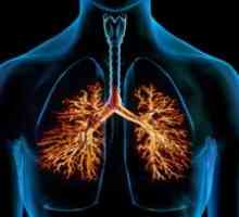 Бронхиектазиите в белите дробове: лечение, симптоми, диагностика, причините, симптомите