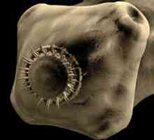 Свинско тения червей паразити, taeniasis болести при човека