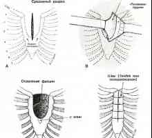 Гърди деформация. дефекти на гръдната кост