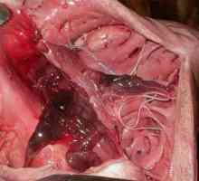 Дирофилариоза (Dirofilaria), червеи в сърцето на човека симптоми, диагностика, лечение и…