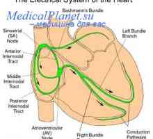 Разпределение на сърдечната контракция. Сърце пейсмейкър