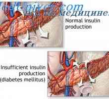 Ефект на инсулин върху метаболизма на въглехидрати. Обмен на глюкоза от инсулин