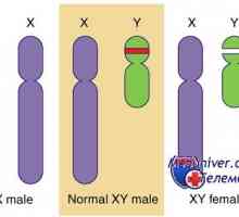 Генетични заболявания на половите жлези. Гените КРЗ, WT1 и синдроми Фрейзър и Денис-dresha