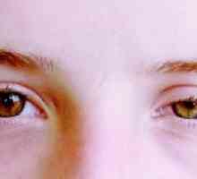 Исхемичен очен Синдром: симптоми, лечение, класификация, причини