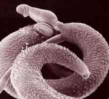 Worms (хелминти) смекчаващи имунитет