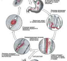 Хелминти (червеи), които живеят в човешките мускули, симптоми и снимки