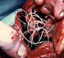 Worms в човешкото тяло