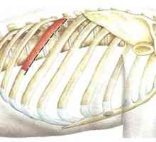 Хирургични подходи към гръбнака на гръдния кош