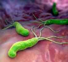 Инфекция на Helicobacter Pylori: лечение, симптоми, причини, диагноза, симптоми