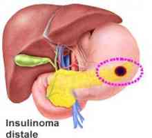 Инсулином на панкреаса