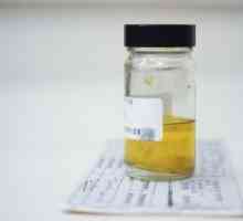 Изследването на урината, анализ на урина