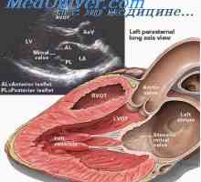Хемодинамичните нарушения при дефекти на сърцето, както и физическо натоварване
