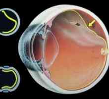 Ембриогенезата ретината
