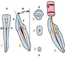 Ендодонтски аспекти на морфологията на по-ниски постоянните зъби