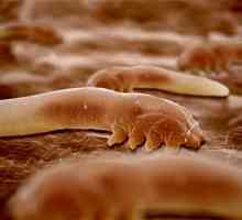Като червеи влияят на човешкото тяло?