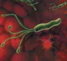 Какво бактерии причинява стомашни язви? Helicobacter Pylori, причинител на пептична язва