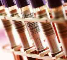 Какво кръв тестове премине в заболявания на панкреаса?