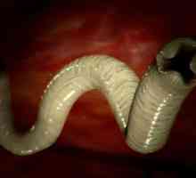 Какви са размерите на червеи (хелминти) в хората?