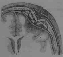 Класификация на огнестрелни наранявания на черепа и мозъка