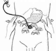 Директен операция на жлъчните пътища с обструктивна жълтеница