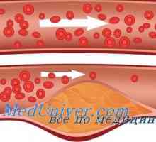 Кожни кръвоносните съдове в захарен диабет. Микроангиопатия при диабет