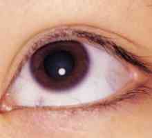 Boundary кератит очите: лечение, причини, симптоми