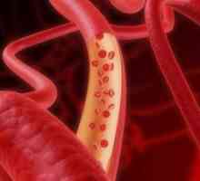 Кървене, причинено от увреждане на кръвоносните съдове