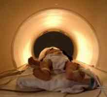 CT и MRI на новороденото бебе