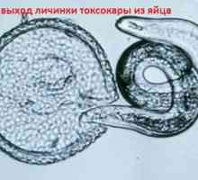 Ларвите и яйца Toxocara висцерална токсокариаза