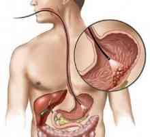 Лимфом на стомаха и дебелото черво: лечение Pronoza, знаци, симптоми, причини