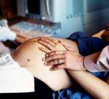 Листериоза по време на бременност, симптоми, лечение