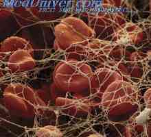 Полицитемия влияние върху циркулацията на кръвта. Белите кръвни клетки са бели кръвни клетки