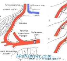 Методи на пъпната артерия катетеризация. Монтаж на уреди пъпна артерия катетър в