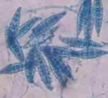 Microsporidiosis при хора: симптоми, лечение