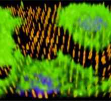 Nanotip да растат нови кръвоносни съдове