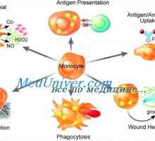 Дисфункция на моноцитите и макрофагите имунитет
