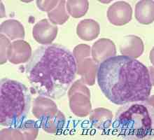 Нарушенията на Т-лимфоцити. CD8 лимфопения
