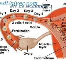 Ненормално място имплантиране на ембриона. Яйчниците и коремната бременност