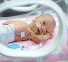 Нервната и неврологично възстановяване на недоносени бебета